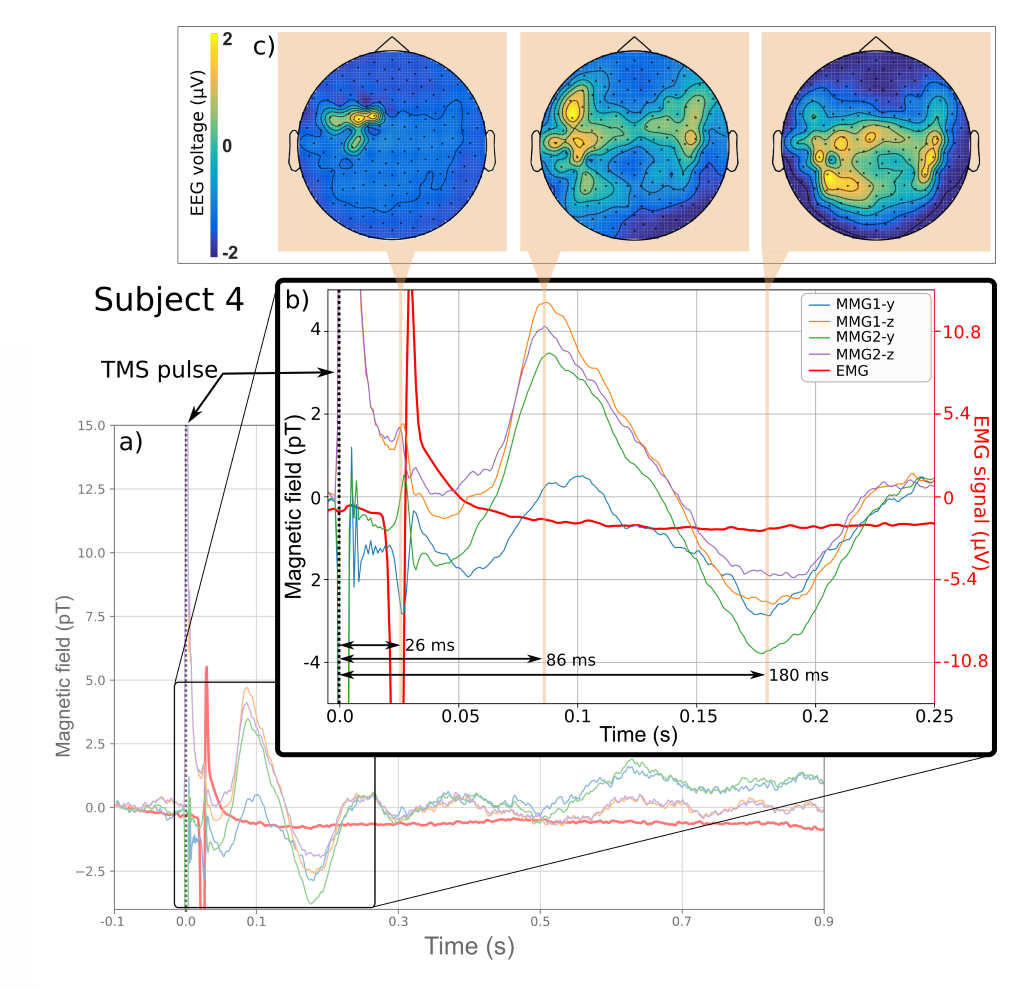 Magnetic fields from the human body – Budker Group – Helmholtz ...